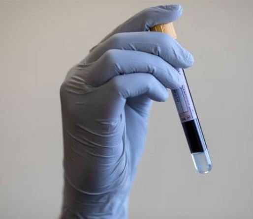 A Blood Test To Lower The Risk Of A Heart Attack