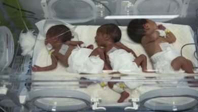 3more Children Died Due To Malnutrition In Gaza, The Number Has Increased To 23