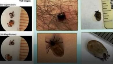 Tick-Borne Diseases