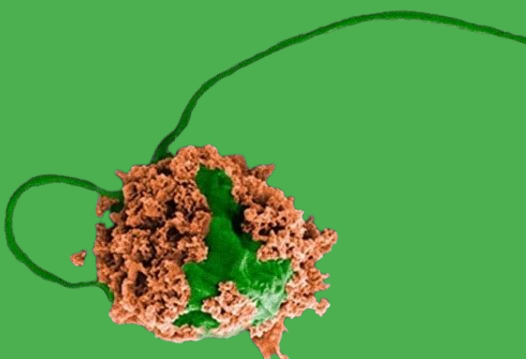 Microbots That Will Go Into The Lungs And Treat Cancer